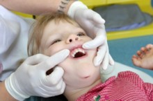 Les accidents sur les dents de lait, urgence dentiste