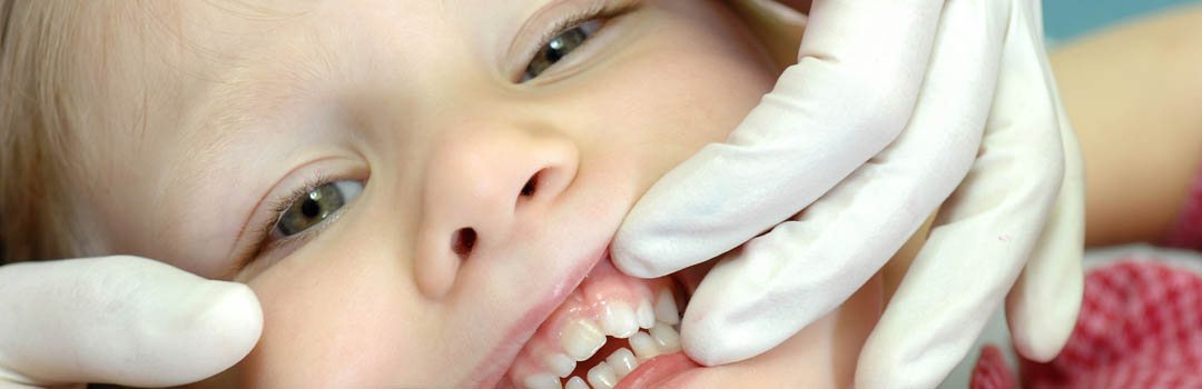 Soins dentaires, dentiste enfant Lausanne