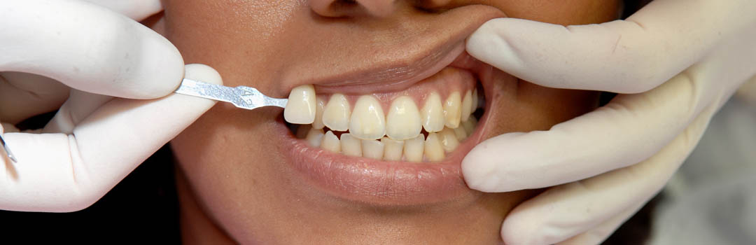 Soins dentaires, Dentiste SSO